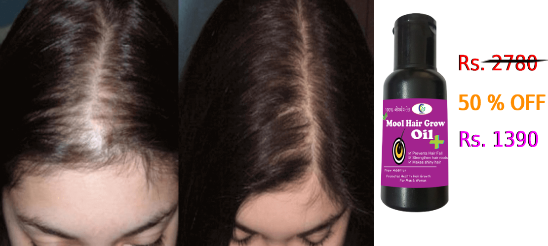 hair fall oil
